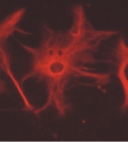 Astrocyte