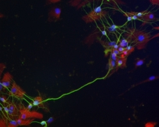 Neuron-Astrocyte
