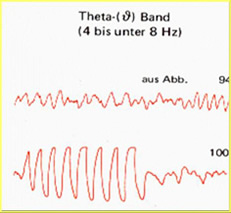 EEG