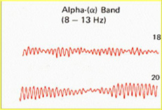 EEG