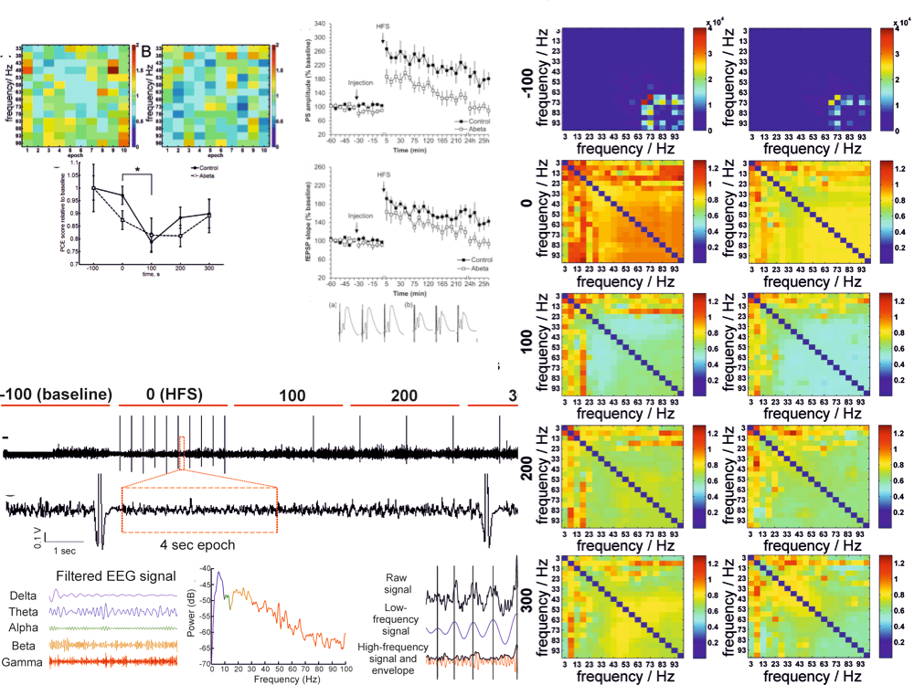 In an animal model of Alzheimer's disease, Amyloid beta impairs hippocampal LTP and network activity