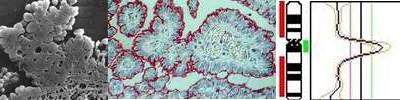 Bildleiste Mesotheliomregister