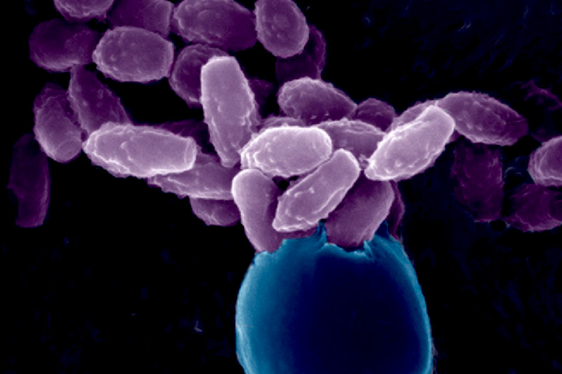 Biologie: Mikroskopaufnahme Pilz