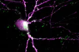 Mikroskopische Aufnahme eines Neurons